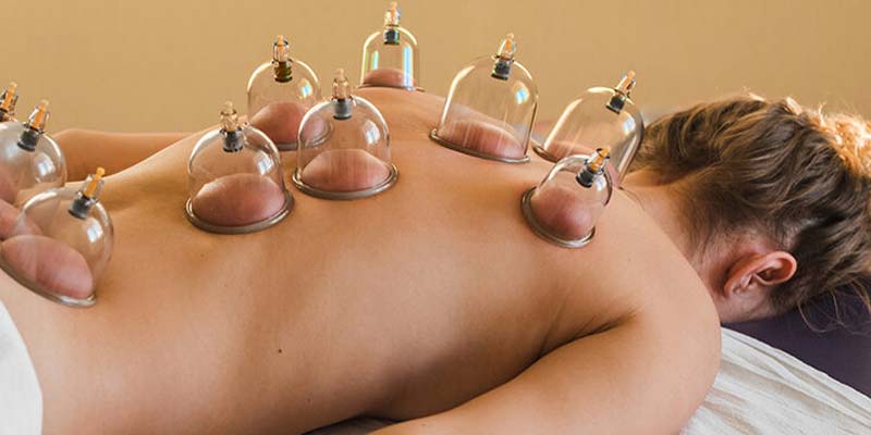 hijama cupping therapy