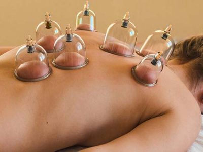 hijama cupping therapy